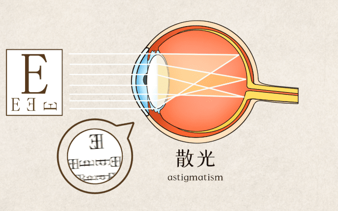 散光