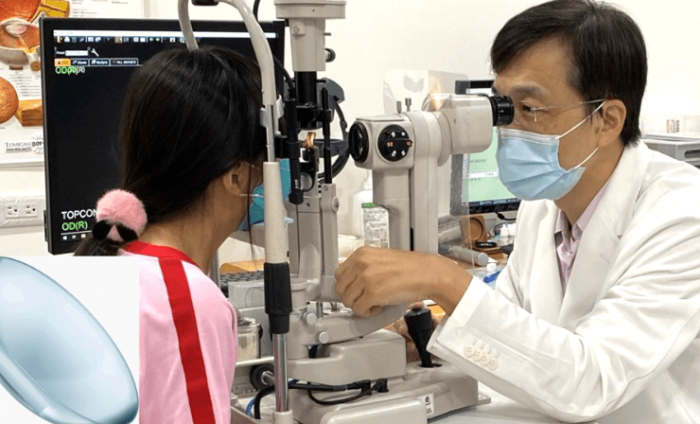 散瞳劑副作用 散瞳劑副作用