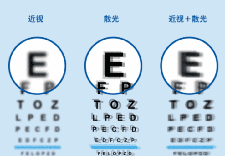 散光症狀 散光症狀