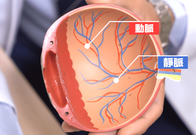 眼中風定義 眼中風定義